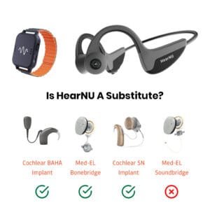 HearNU hearing aid for Deaf Substitute cochlear